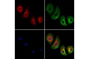 ABIN7094454 and ABIN7098502 staining Hela cells by IF/ICC. (SCD 抗体  (N-Term))