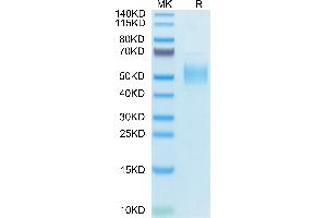 PLA2G7 Protein (AA 22-441) (His tag)