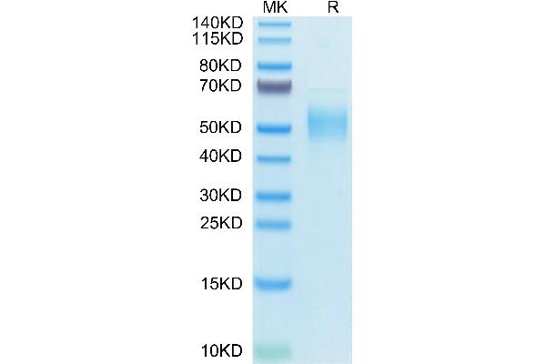 PLA2G7 Protein (AA 22-441) (His tag)