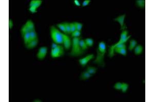 Immunofluorescence staining of MCF-7 cells with ABIN7150910 at 1:100, counter-stained with DAPI. (DTNBP1 抗体  (AA 258-351))