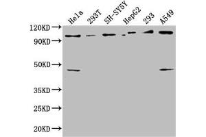 Western Blot Positive WB detected in: Hela whole cell lysate, 293T whole cell lysate, SH-SY5Y whole cell lysate, HepG2 whole cell lysate, 293 whole cell lysate, A549 whole cell lysate All lanes: RABEP1 antibody at 1:2500 Secondary Goat polyclonal to rabbit IgG at 1/50000 dilution Predicted band size: 100, 96 kDa Observed band size: 100 kDa (RABEP1 抗体  (AA 1-255))