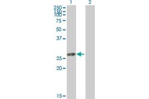 Western Blot analysis of TK1 expression in transfected 293T cell line by TK1 MaxPab polyclonal antibody. (TK1 抗体  (AA 1-234))