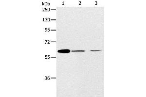 Western Blot analysis of NIH/3T3 and SKOV3 cell, Human ovarian cancer tissue using ABCE1 Polyclonal Antibody at dilution of 1:450 (ABCE1 抗体)