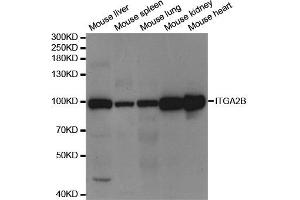Western Blotting (WB) image for anti-Integrin Alpha2b (CD41) antibody (ABIN1876881) (Integrin Alpha2b 抗体)