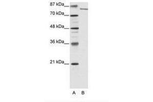 Image no. 2 for anti-Lysine (K)-Specific Demethylase 2A (KDM2A) (N-Term) antibody (ABIN6736177) (KDM2A 抗体  (N-Term))
