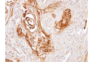 IHC-P Image Immunohistochemical analysis of paraffin-embedded Cal27 xenograft, using DNAJC7, antibody at 1:100 dilution.