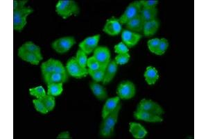Immunofluorescence staining of HepG2 cells with ABIN7174468 at 1:100, counter-stained with DAPI. (UBE2L3 抗体  (AA 1-154))