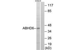 Western blot analysis of extracts from COLO cells, using ABHD6 Antibody. (ABHD6 抗体  (AA 231-280))