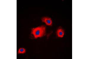Immunofluorescent analysis of PI3K p85 alpha/p55 gamma staining in HeLa cells. (PIK3R3 抗体  (Center))