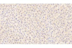 Detection of MSP in Rat Liver Tissue using Polyclonal Antibody to Macrophage Stimulating Protein (MSP)