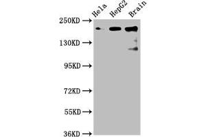Western Blot Positive WB detected in: Hela whole cell lysate, HepG2 whole cell lysate, Rat brain tissue All lanes: CKAP5 antibody at 6 μg/mL Secondary Goat polyclonal to rabbit IgG at 1/50000 dilution Predicted band size: 226, 219, 227 kDa Observed band size: 226 kDa (CKAP5 抗体  (AA 1802-2019))