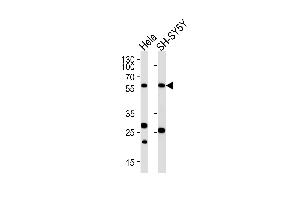 Western blot analysis of lysates from Hela,SH-SY5Y cell line (from left to right),using CALR Antibody (ABIN484301 and ABIN1533682). (Calreticulin 抗体)