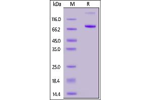 SDS-PAGE (SDS) image for CD4 (CD4) (AA 26-396) (Active) protein (Fc Tag,FITC) (ABIN6923184)