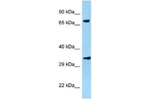 WB Suggested Anti-Pja2 Antibody   Titration: 1. (PJA2 抗体  (N-Term))
