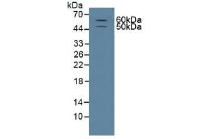 Detection of CD15 in Rat Brain Tissue using Polyclonal Antibody to Cluster Of Differentiation 15 (CD15) (CD15 抗体  (AA 264-497))