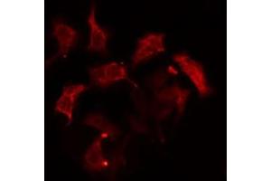ABIN6274963 staining HepG2  cells by IF/ICC. (CA6 抗体  (C-Term))