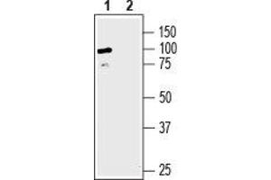 Western Blotting (WB) image for anti-Solute Carrier Family 6 (Neurotransmitter Transporter, Creatine), Member 8 (SLC6A8) (AA 46-60), (Extracellular) antibody (ABIN7043739)
