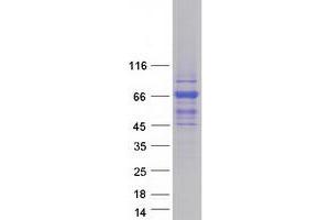 Western Blotting (WB) image for TBC1 Domain Family, Member 10A (TBC1D10A) protein (Myc-DYKDDDDK Tag) (ABIN2733256)