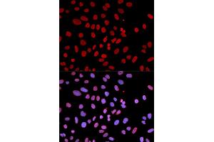 Immunofluorescence analysis of U2OS cells using PTPN6 antibody (ABIN5970673). (SHP1 抗体)
