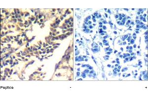 Image no. 1 for anti-Cas-Br-M (Murine) Ecotropic Retroviral Transforming Sequence (CBL) (Tyr700) antibody (ABIN401654) (CBL 抗体  (Tyr700))