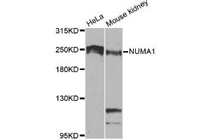 Western blot analysis of extracts of various cell lines, using NUMA1 antibody. (NUMA1 抗体)