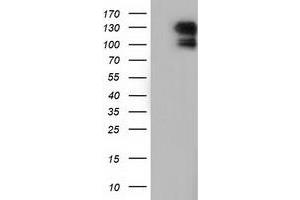 Image no. 1 for anti-Microtubule Associated Monoxygenase, Calponin and LIM Domain Containing 1 (MICAL1) antibody (ABIN1499462)
