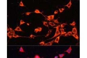 Immunofluorescence analysis of NIH/3T3 cells using ABCB10 Polyclonal Antibody at dilution of 1:100. (ABCB10 抗体)