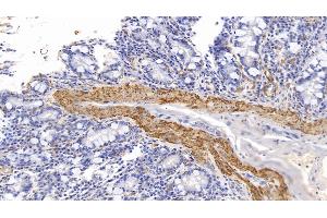 Immunohistochemistry (IHC) image for anti-Actin, Alpha, Cardiac Muscle 1 (ACTC1) (AA 156-368) antibody (ABIN7428392)