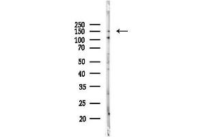 Western blot analysis of lysates from PC12 cells(UV, 30 min treatment), using ABCC11 Antibody at 1/1000 dilution.