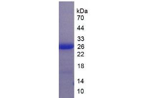SDS-PAGE analysis of Human LILRB3 Protein. (LILRB3 蛋白)