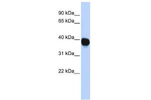 WB Suggested Anti-TPST2 Antibody Titration:  0. (TPST2 抗体  (Middle Region))