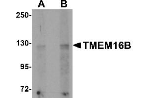 Western blot analysis of TMEM16B in rat brain tissue lysate with TMEM16B antibody at (A) 1 and (B) 2 µg/mL. (Anoctamin 2 抗体  (N-Term))