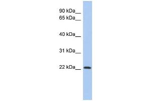 WB Suggested Anti-ZNF833P Antibody Titration:  0. (LOC401898 抗体  (N-Term))