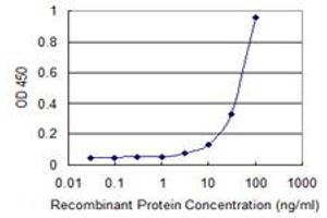 Detection limit for recombinant GST tagged ZSCAN1 is 1 ng/ml as a capture antibody. (ZSCAN1 抗体  (AA 315-407))