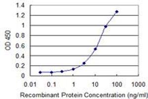 Detection limit for recombinant GST tagged NAT5 is 0. (NAT5 抗体  (AA 1-178))