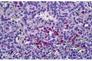 Human Spleen: Formalin-Fixed, Paraffin-Embedded (FFPE) (Retinol Binding Protein 5 抗体  (AA 10-59))
