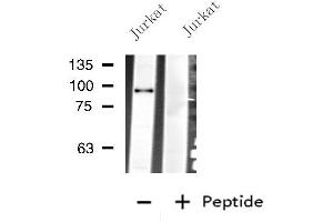 Western blot analysis of extracts from Jurkat cells, using PLG antibody.