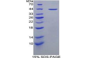 SDS-PAGE of Protein Standard from the Kit (Highly purified E. (Major Basic Protein ELISA 试剂盒)