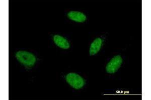 Immunofluorescence of monoclonal antibody to NFYB on HeLa cell. (NFYB 抗体  (AA 1-207))