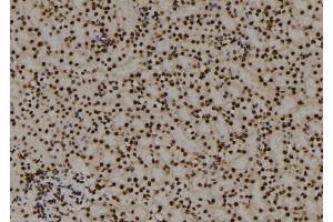 ABIN6278676 at 1/100 staining Mouse kidney tissue by IHC-P. (PITX3 抗体)