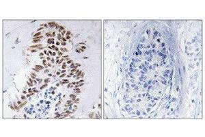 Immunohistochemistry (IHC) image for anti-Death-Associated Protein Kinase 3 (DAPK3) (Thr265) antibody (ABIN1848018) (DAPK3 抗体  (Thr265))