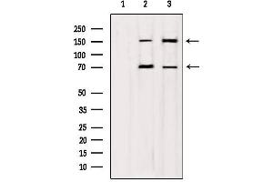 Western blot analysis of extracts from various samples, using mDia1 Antibody. (DIAPH1 抗体)