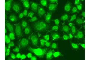Immunofluorescence analysis of A549 cells using TSEN2 antibody (ABIN5975732). (TSEN2 抗体)
