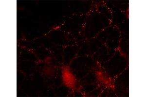 Indirect immunostaining of cultured hippocampus neurons (dilution 1 : 200). (SV2B 抗体  (AA 2-17))