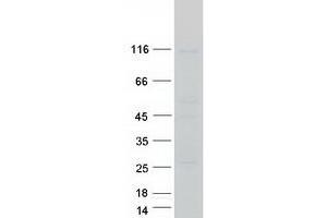 AGLU Protein (Transcript Variant 2) (Myc-DYKDDDDK Tag)