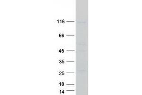 AGLU Protein (Transcript Variant 2) (Myc-DYKDDDDK Tag)