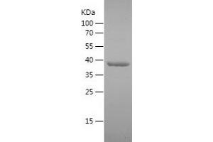 Western Blotting (WB) image for DEAD (Asp-Glu-Ala-Asp) Box Polypeptide 3, Y-Linked (DDX3Y) (AA 196-372) protein (His-IF2DI Tag) (ABIN7122606) (DDX3Y Protein (AA 196-372) (His-IF2DI Tag))
