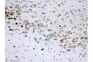 IHC analysis of RPS6 using anti- RPS6 antibody . (RPS6 抗体  (N-Term))