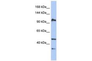 Image no. 1 for anti-XPA Binding Protein 2 (XAB2) (AA 35-84) antibody (ABIN6743564) (XAB2 抗体  (AA 35-84))