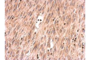IHC-P Image SOS2 antibody detects SOS2 protein at cytosol on U87 xenograft by immunohistochemical analysis. (SOS2 抗体  (Center))